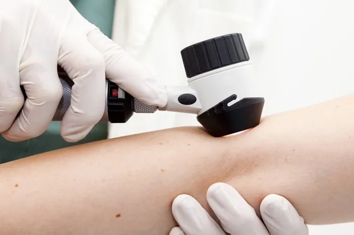 dermatoscopia fabiana errico dermatologa